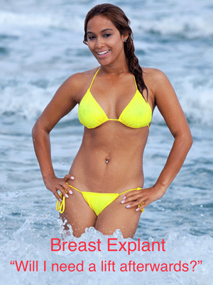 Is a Mastopexy or a Breast Lift Always Needed? - Part 3