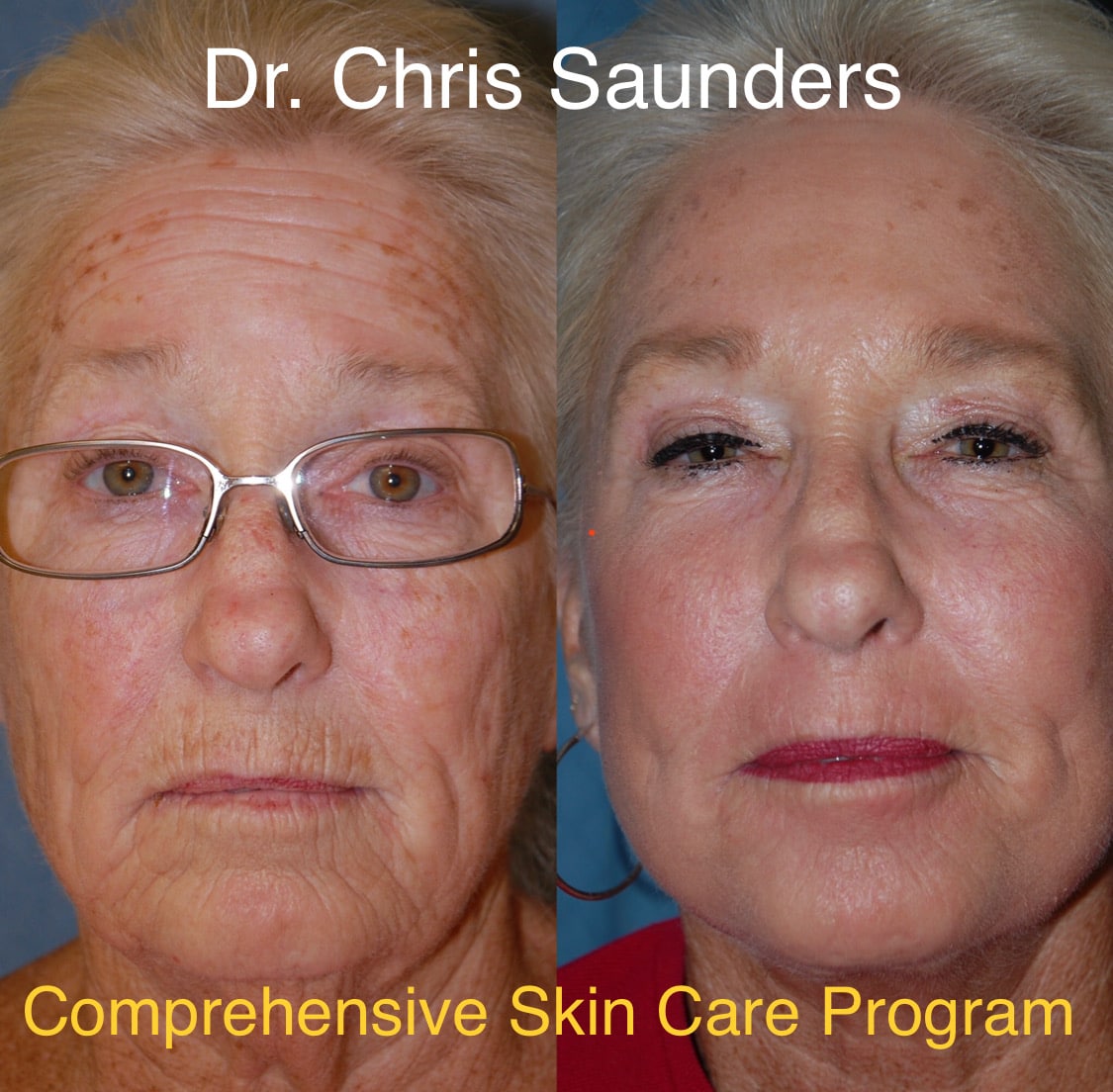 Dr.Chris Saunders - comprehensive skin care program
