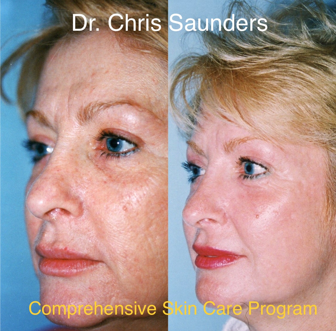 comprehensive skin care program-Dr.Chris Saunders 