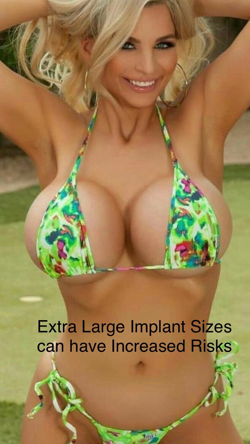 10 problems after a big boob job