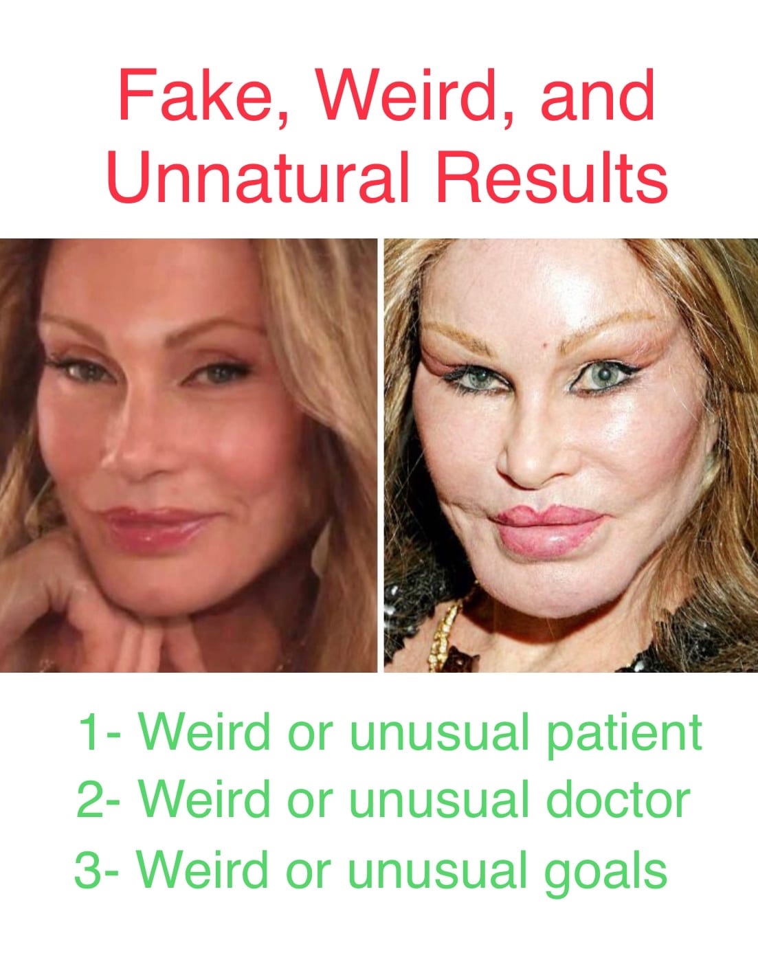 Fake, Weird, Bad, and Unnatural Results in Cosmetic and Plastic Surgery :  How and Why Do They Happen? - Dr. Chris Saunders MD